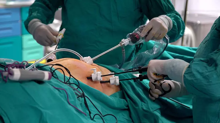 Các bác sĩ Bệnh viện FV thực hiện phẫu thuật cắt tạo hình dạ dày hình ống