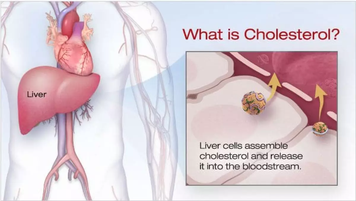 Nguyên nhân dẫn đến cholesterol cao - cách phòng tránh