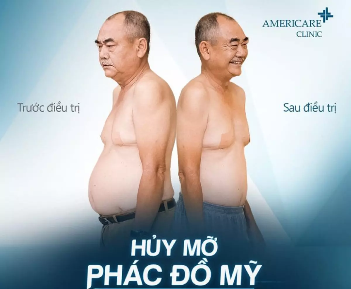 NSND Việt Anh trong đoạn clip giảm béo tại Americare Clinic